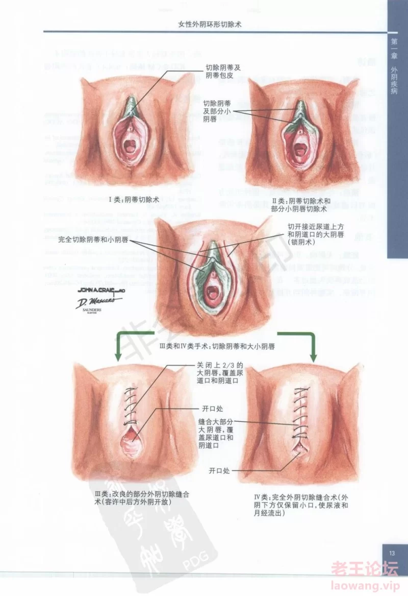 奈特妇产科彩色图谱-2007_22.jpg